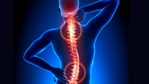 Pain Relief via a Spinal Cord Stimulator